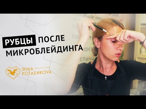 Видео: МИКРОБЛЕЙДИНГ. Кому не подходит? ☝️Техника безопасности!