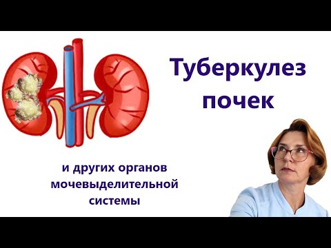 Видео: Туберкулез мочевыделительной системы