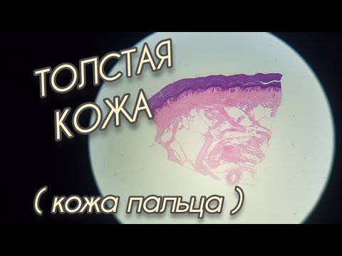 Видео: ТОЛСТАЯ #кожа