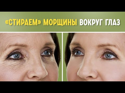 Видео: Как избавиться от морщин "гусиных лапок"