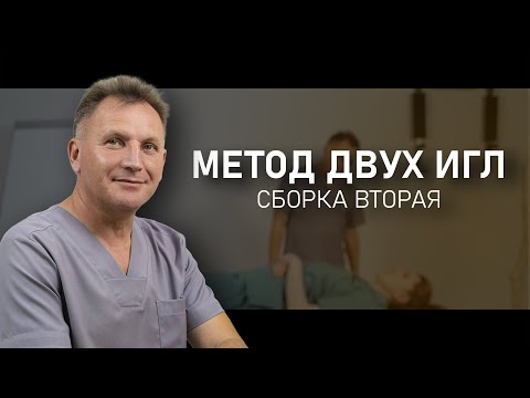 Видео: МЕТОД ДВУХ ИГЛ. Сборка II | Владимир Александров