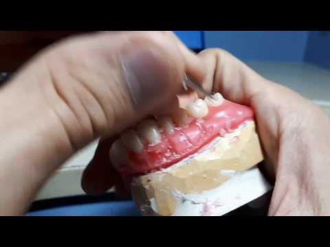 Видео: моделировка десны