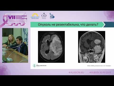 Видео: Курносов И.А. | Хирургическое лечение первичных и вторичных опухолей ЦНС
