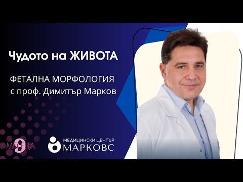 Видео: Да видиш чудото: Какво разкрива феталната морфология с проф. Димитър Марков