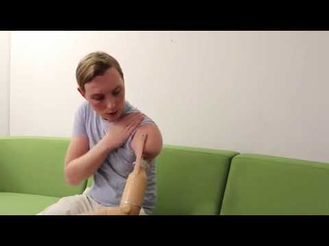 Видео: Преимущества и недостатки остеоинтеграции - Кристоффер Линде, инвалид с тройной ампутацией - Влог 30