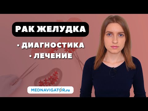 Видео: Как ВЫЛЕЧИТЬ РАК ЖЕЛУДКА? Диагностика и лечение ОПУХОЛЕЙ ЖЕЛУДКА #меднавигатор