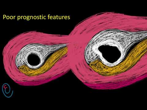 Видео: Объяснение УЗИ на ранних сроках беременности: GS, YS и FP