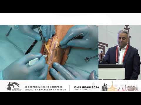 Видео: Назарян Г.А.: задний межкостный лоскут предплечья.