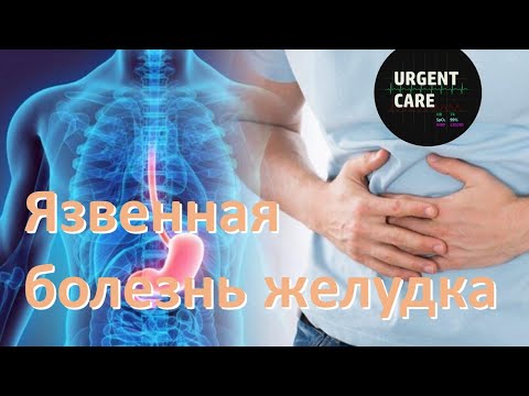 Видео: Язвенная болезнь желудка