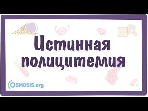 Видео: Истинная полицитемия — причины, симптомы, патогенез, диагностика, лечение