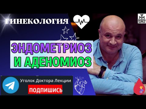 Видео: Эндометриоз и аденомиоз - близнецы или близкие родственники?
