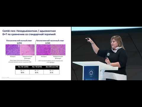 Видео: Плюсы неоадъювантной терапии меланомы