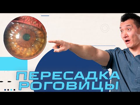 Видео: Пересадка Роговицы Глаза