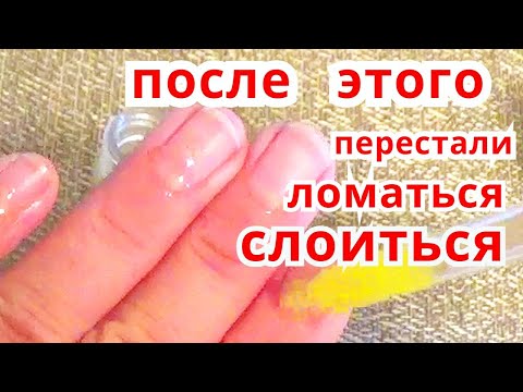 Видео: Слоятся Ломаются Ногти КАК УКРЕПИТЬ НОГТИ ? Средство От Ломкости Ногтей Рецепт