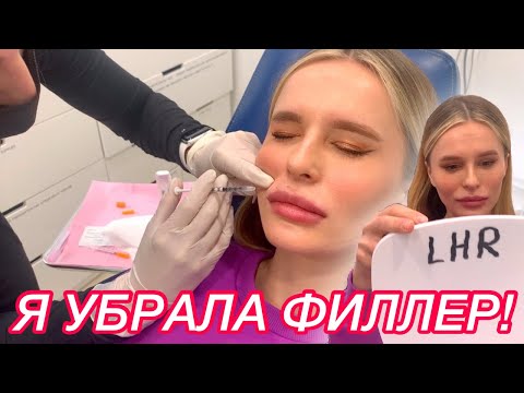 Видео: Я УМЕНЬШИЛА ГУБЫ!👄 И это было самым лучшим решением в жизни! / I dissolved my lips | Julia Prell |