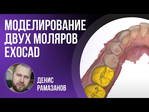 Видео: Моделирование двух моляров exocad