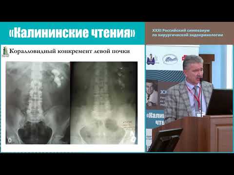 Видео: ПЕРВИЧНЫЙ ГИПЕРПАРАТИРЕОЗ У ДЕТЕЙ И ВЗРОСЛЫХ.