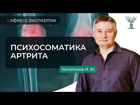 Видео: Психосоматика ревматоидного полиартрита // Игорь Капитонов