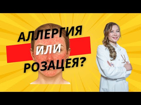 Видео: Что такое розацея? Причины и механизм развития болезни