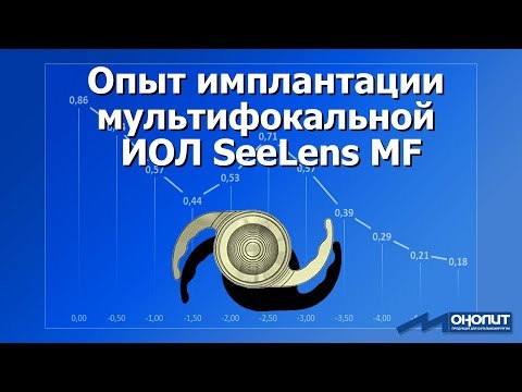 Видео: Опыт имплантации мультифокальной ИОЛ SeeLens MF