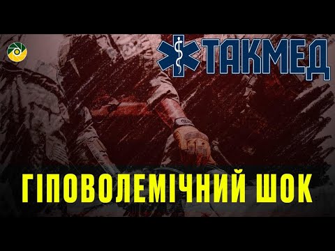 Видео: ТАКМЕД. Гіповолемічний шок. Випуск 10
