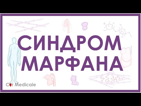 Видео: Синдром Марфана - механизм развития, причины, клинические проявления