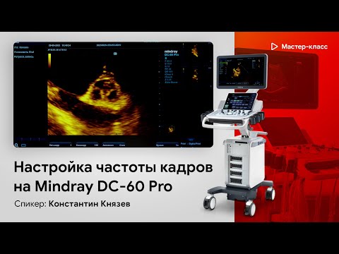 Видео: Настройка частоты кадров на примере Mindray DC-60 Pro