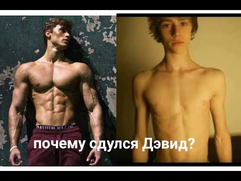 Видео: Дэвид Лейд - инвалид в 22 года? Почему Лейд "сломался" и слил форму?