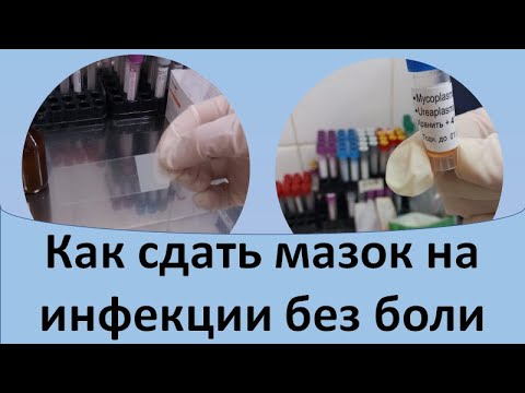 Видео: Как сдать мазок на инфекции без боли