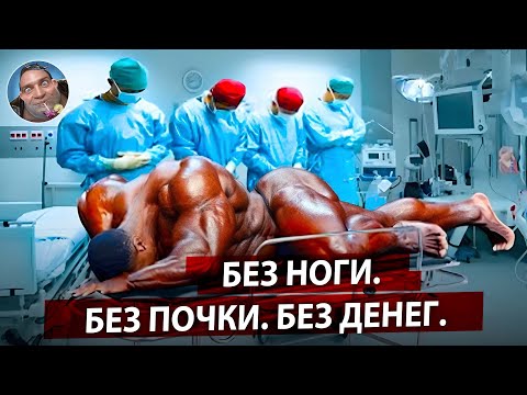 Видео: 10 Культуристов Которые Доигрались