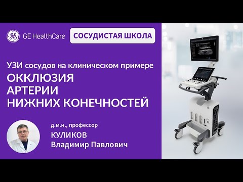 Видео: Сосудистая школа GE Healthcare. Окклюзия артерий нижних конечностей. Сессия №17