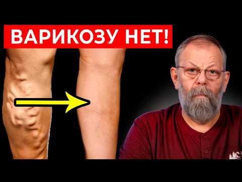 Видео: Задержи дыхание на 5 секунд и варикоза нет!