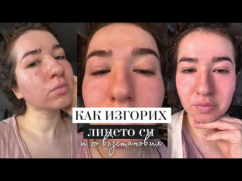 Видео: КАК ИЗГОРИХ ЛИЦЕТО СИ?