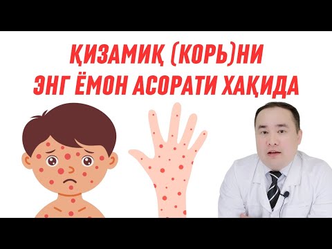 Видео: ҚИЗАМИҚ (КОРЬ)  ЭНГ ЁМОН АСОРАТИ ВА УНИ ОЛДИНИ ОЛИШ ХАҚИДА ИСЧАНОВ