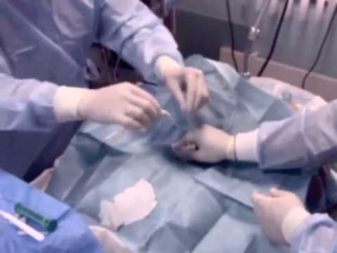 Видео: Трахеостомия в нейрореанимации А.С.Горячев (2МСН)