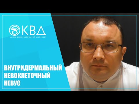 Видео: 1280  Внутридермальный невоклеточный невус