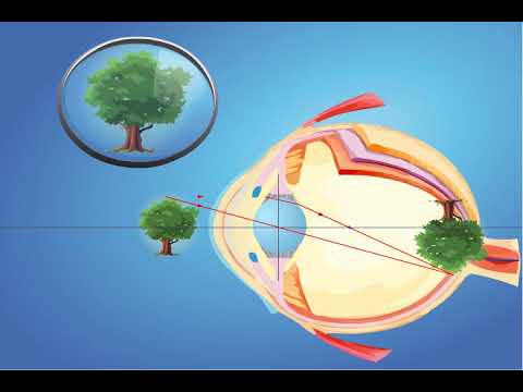 Видео: Көз - оптикалық құрал. 8-сынып