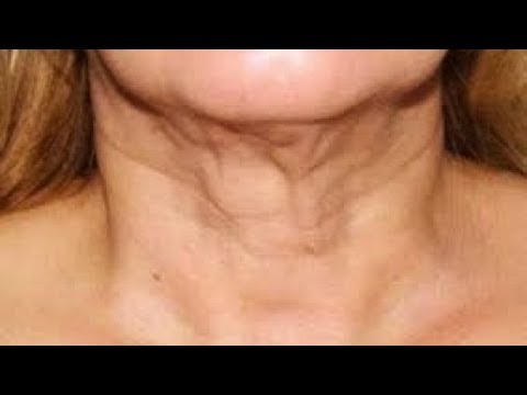 Видео: Морщины на лице и шее?? - Займись спиной!