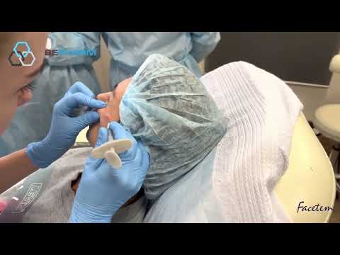 Видео: Применение препарата FACETEM в средней и нижней трети