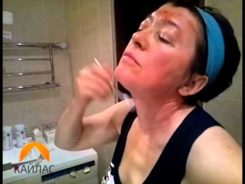 Видео: Как пользоваться мезороллером дома