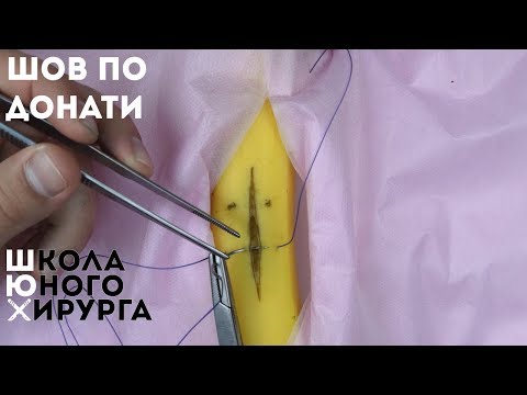 Видео: шов мак-миллана - донати или вертикальный п-образный шов (техника; как наложить)