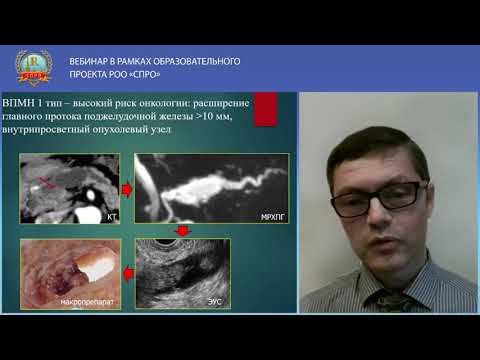 Видео: Лекция: «Значение МРТ в комплексной лучевой диагностике кистозных неоплазий поджелудочной железы»