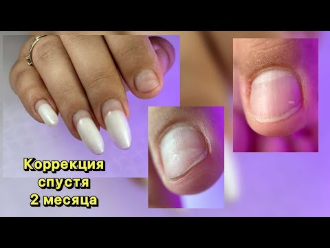 Видео: КОРРЕКЦИЯ СПУСТЯ 2 МЕСЯЦА. МАНИКЮР ОНЛАЙН. Виктория Авдеева