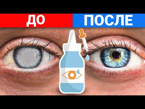 Видео: 5 ЛУЧШИХ СРЕДСТВ ОТ КАТАРАКТЫ