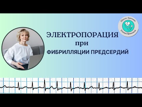 Видео: Электропорация при фибрилляции предсердий