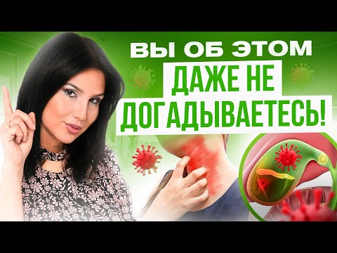 Видео: Аллергия и желчный пузырь. Настоящая причина аллергии!