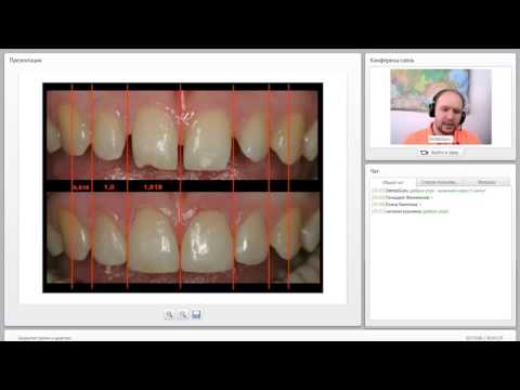 Видео: 2014 06 17 Закрытие трем и диастем  0001