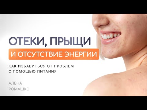 Видео: Отёки, прыщи и отсутствие энергии. Как избавиться от проблем с помощью питания?