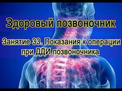 Видео: Занятие 33. Показания к оперативному вмешательству на больном позвоночнике.