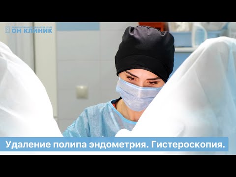 Видео: Гистероскопия. Удаление полипа эндометрия в ОН КЛИНИК.